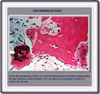 Microfotografa de osteoclastos