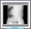 Imagen radiografica