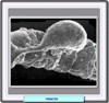 Microfotografía electrónica de un pericito