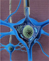 Estructura esquemática de una neuroma