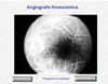 Angiografia fluoresceína