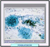 Microfotografía mostrando los aglomerados de células fúngicas