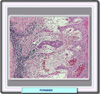 Histología de la perniosis