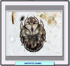 Microfotografía del Sarcoptes scabiei