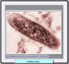 Microfotografía del bacilo de la tuberculosis