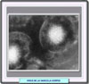 Microfotografía electronica del virus szoster