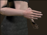 Ejercicio de rehabilitación de la mano en la esclerosis múltiple