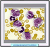 Leucemia mielomonocítica crónica