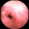 Imagen endoscópica