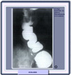 Imagen radiográfica