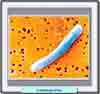Microfotogarfía del tétanos
