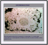 Microfografía de virus de la rubeóla