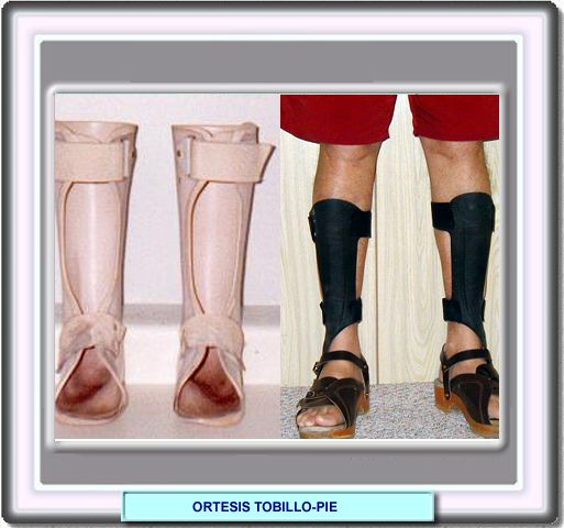 Zapatos especiales para pie charcot sales