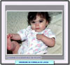 Imagen clínica de una niña con el síndrome de Cornelia de Lange