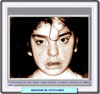 Fotografía de un niño con el síndrome de Coffin-Siris