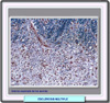 Microfografía