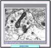 Microscopía electrónica
