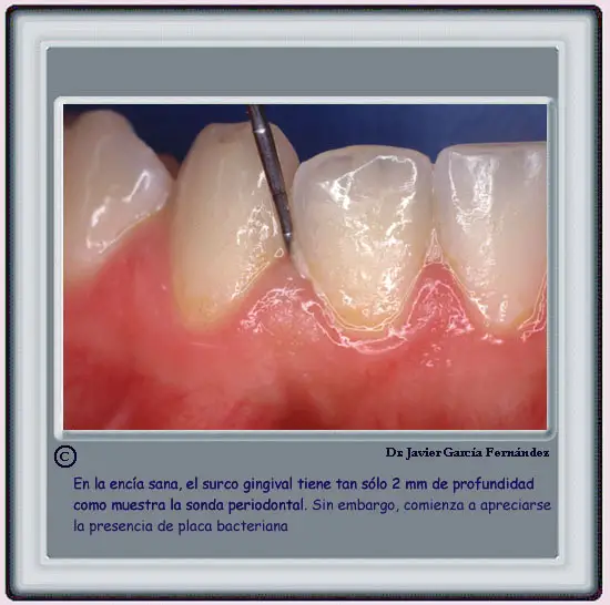 Atlas of Surgical Techniques in Periodontics. Chapter I. Periodontal