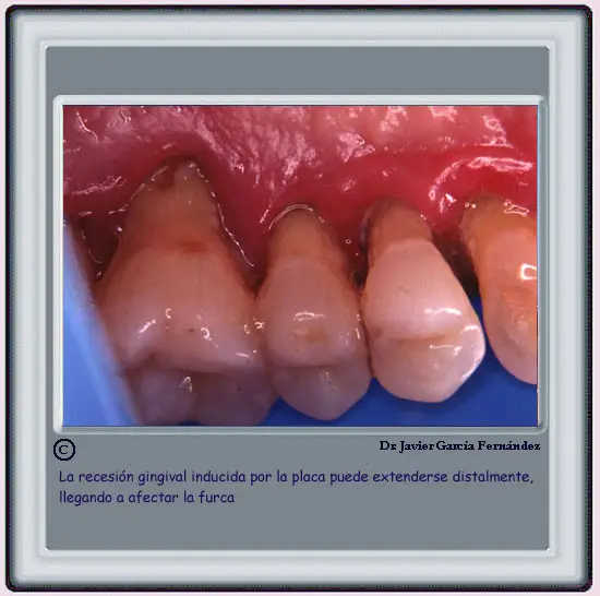 Atlas of Surgical Techniques in Periodontics. Chapter I. Periodontal
