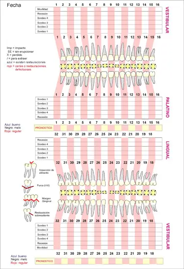 Periodontograma